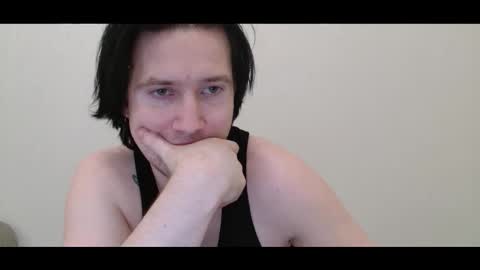 vitiligoboyy online show from 03.03.26